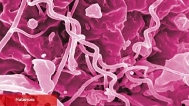 Antibiyotik Eksikliği Frengi Salgınını Kötüleştirebilir