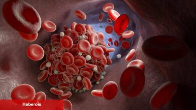 Pıhtı Atmasını Nasıl Önleyebilirsiniz? Canan Karatay Cevapladı! - Haberois Pıhtı Atmasını Nasıl Önleyebilirsiniz? Canan Karatay Cevapladı!