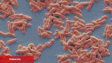 Cüzzam Orta Florida'da Endemik Olabilir, Bilim Adamları Raporu - Haberois Cüzzam Orta Florida'da Endemik Olabilir, Bilim Adamları Raporu