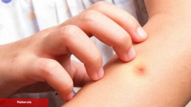 Sivrisinekler neden kimi insanları daha çok ısırır? - Haberois Sivrisinekler neden kimi insanları daha çok ısırır?