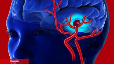 Uzmanlar uyardı! "Beyne pıhtı atmasında birinci 4,5 saat çok kritik" - Haberois Uzmanlar uyardı! "Beyne pıhtı atmasında birinci 4,5 saat çok kritik"