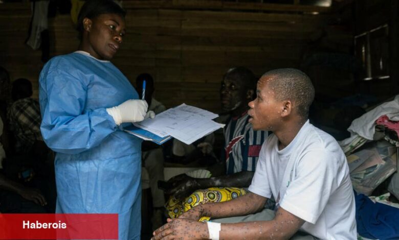 Aşı, Test veya Tedavi Yok: Kongo'da Mpox ile Başa Çıkmak İçin Araçlar Yok - Haberois Aşı, Test veya Tedavi Yok: Kongo'da Mpox ile Başa Çıkmak İçin Araçlar Yok
