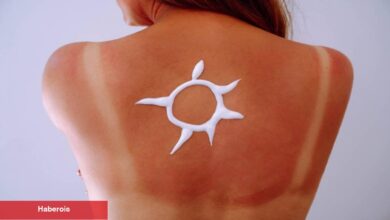 Bu usulle mayo ve bikini izlerinden kurtulun!