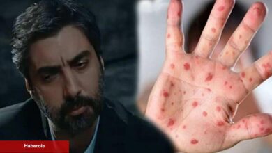 Kurtlar Vadisi dizisinde Maymun çiçeği virüsü sahnesi gündem oldu!Meğer 10 yıl evvel anlatmışlar