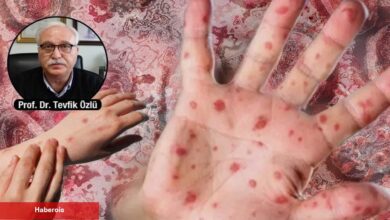 Maymun çiçeği virüsünde toplu taşımalara dikkat! 'Salgınlarla yaşamaya alışılmalı' - Haberois Maymun çiçeği virüsünde toplu taşımalara dikkat! 'Salgınlarla yaşamaya alışılmalı'