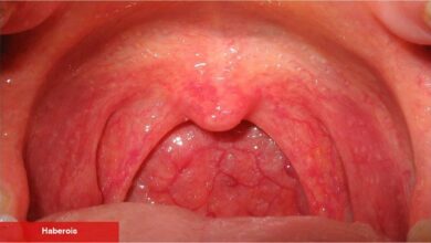 Boğaz ağrısının gerisindeki bilinmeyen tehdit: Faranjit