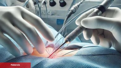 Kalp ritim bozukluğuna mucize üzere formül: Ablasyon tedavisi - Haberois Kalp ritim bozukluğuna mucize üzere formül: Ablasyon tedavisi