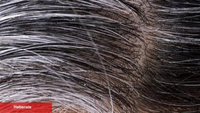 Saç neden beyazlar? İşte 6 nedeni! - Haberois Saç neden beyazlar? İşte 6 nedeni!