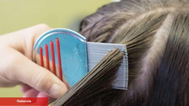 Saçtaki bit yumurtaları nasıl yok edilir? Sirke, pire ve bit yumurtası kaç günde geçer?