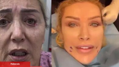 Seda Sayan'ın ablası resmen yüz nakli yaptırdı! Nursel Yıldız'ın son hali ortaya çıktı - Haberois Seda Sayan'ın ablası resmen yüz nakli yaptırdı! Nursel Yıldız'ın son hali ortaya çıktı