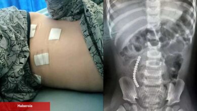 Öldüren TikTok akımı: 12 yaşındaki çocuk son anda kurtarıldı - Haberois Öldüren TikTok akımı: 12 yaşındaki çocuk son anda kurtarıldı