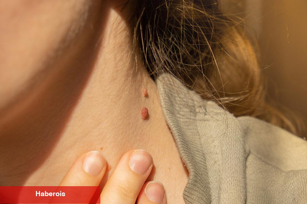 Ben aldırmak riskli mi? - Haberois Ben aldırmak riskli mi?