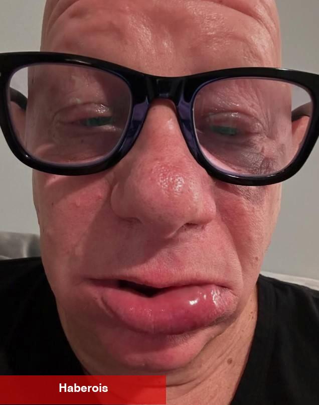 Dünyaca ünlü komedyen Jeff Ross dondurma yüzünden kabus yaşadı: Hastanelik oldu! - Haberois Dünyaca ünlü komedyen Jeff Ross dondurma yüzünden kabus yaşadı: Hastanelik oldu!