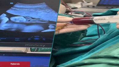 Anne karnındaki bebeğe kan nakli yapıldı - Haberois Anne karnındaki bebeğe kan nakli yapıldı