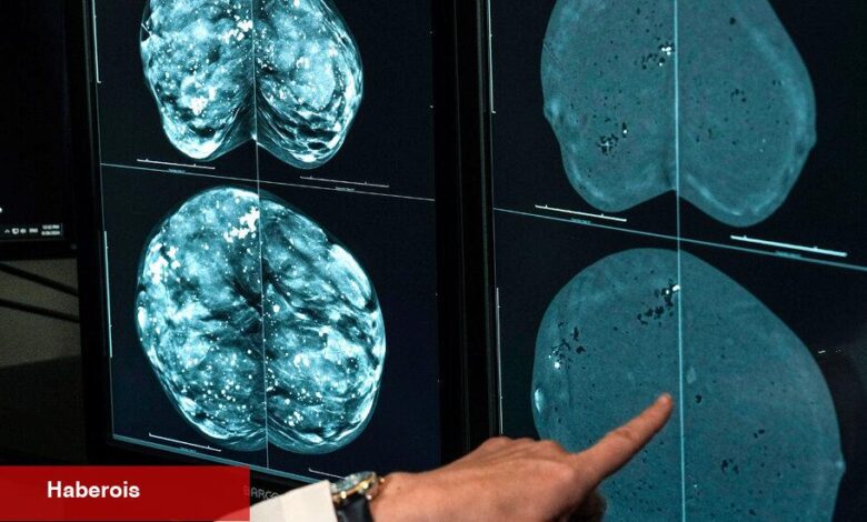 Bir tür mamogram yoğun göğüsleri olan kadınlar için daha iyi olur - Haberois Bir tür mamogram yoğun göğüsleri olan kadınlar için daha iyi olur