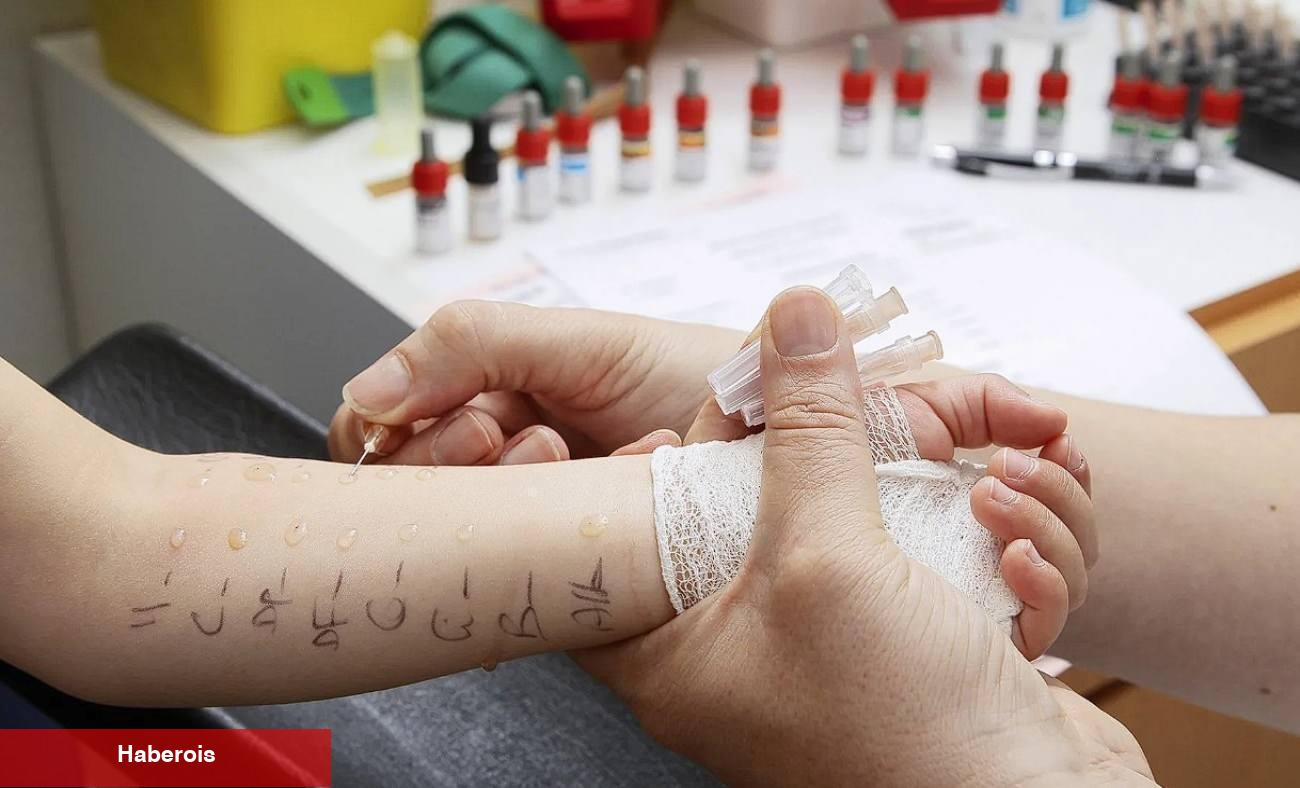 Çocuklarda alerji testi nasıl yapılır? Deri prick testi nedir? - Haberois Çocuklarda alerji testi nasıl yapılır? Deri prick testi nedir?