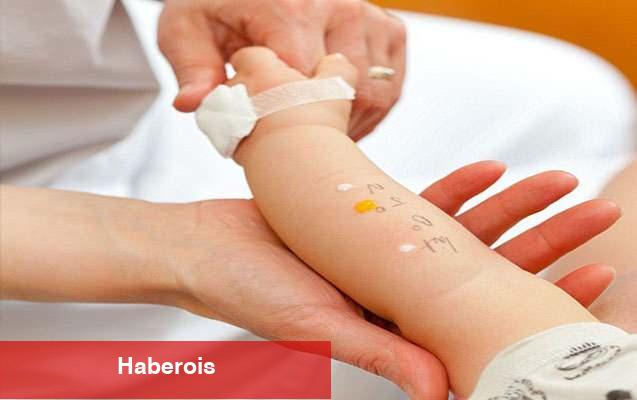Çocuklarda alerji testi nasıl yapılır? Deri prick testi nedir? - Haberois Çocuklarda alerji testi nasıl yapılır? Deri prick testi nedir?
