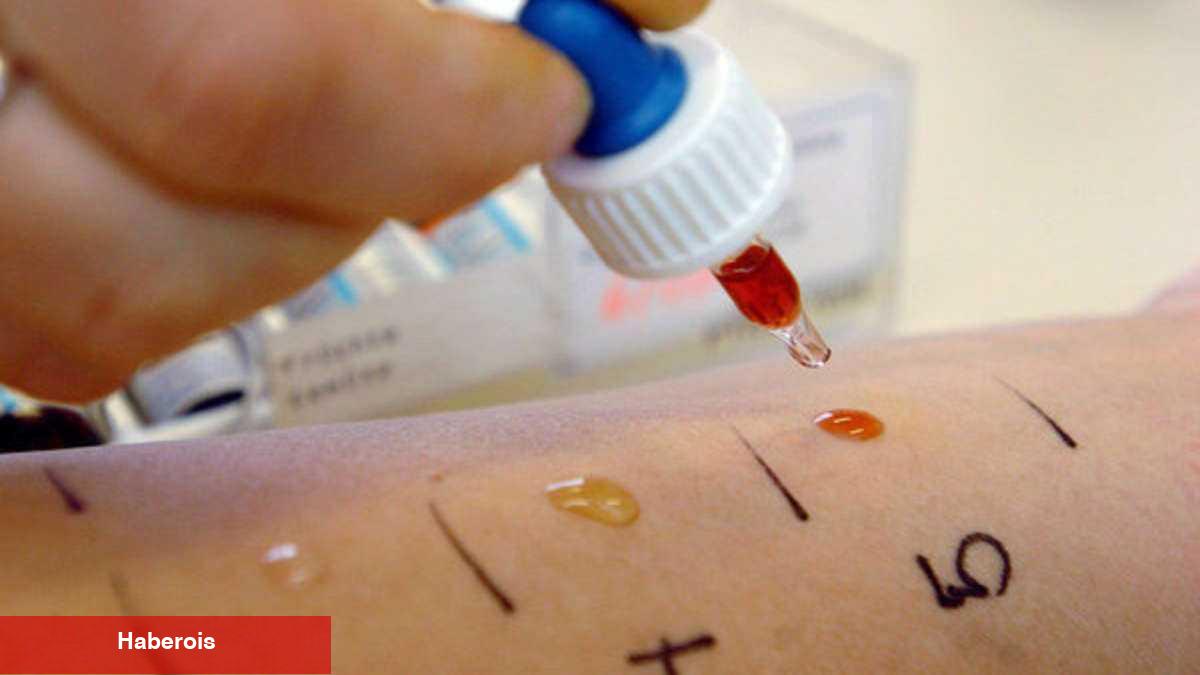 Çocuklarda alerji testi nasıl yapılır? Deri prick testi nedir? - Haberois Çocuklarda alerji testi nasıl yapılır? Deri prick testi nedir?