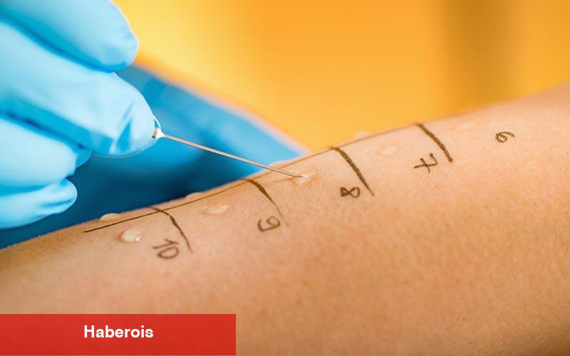 Çocuklarda alerji testi nasıl yapılır? Deri prick testi nedir? - Haberois Çocuklarda alerji testi nasıl yapılır? Deri prick testi nedir?