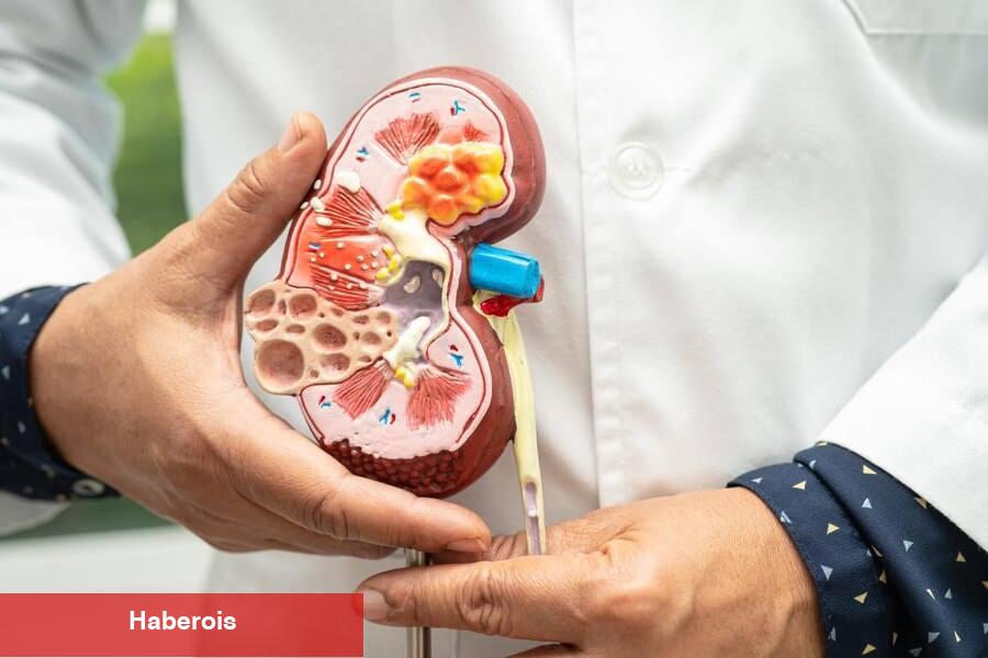 Her 8 şahıstan birinde görülüyor! Böbrek taşıyla hayatınız kabusa dönmesin