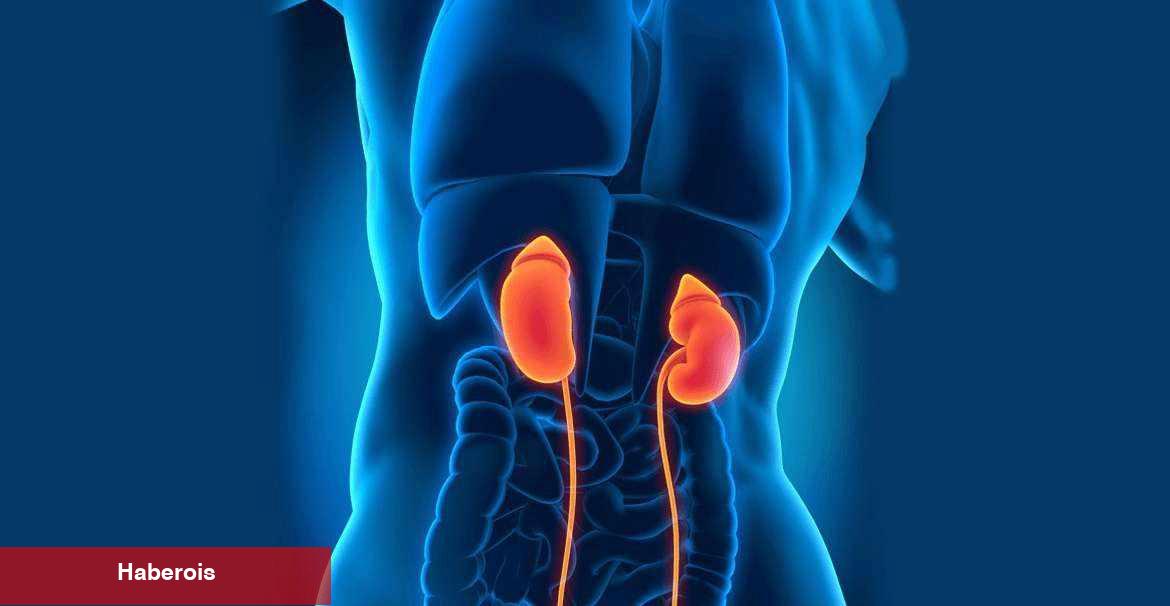 Her 8 şahıstan birinde görülüyor! Böbrek taşıyla hayatınız kabusa dönmesin