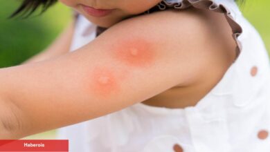 Bebek ve çocuklarda sivrisinek ısırıkları: Tedavisi ve tedbire yolları - Haberois Bebek ve çocuklarda sivrisinek ısırıkları: Tedavisi ve tedbire yolları