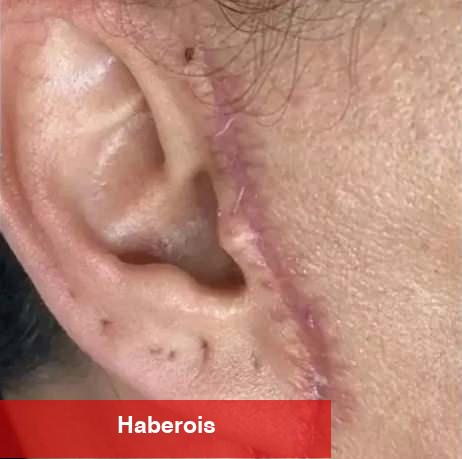 Hoşlaşmak isterken sıhhatinden oldu! Kulağı kesilip yüzüne dikildi