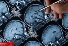 Kan testleriyle Alzheimer’ın birinci belirtileri tespit edilebilir