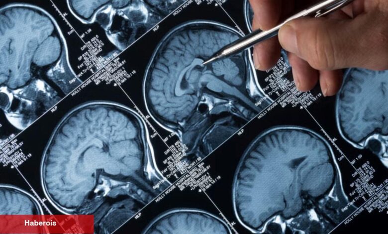 Kan testleriyle Alzheimer’ın birinci belirtileri tespit edilebilir - Haberois Kan testleriyle Alzheimer’ın birinci belirtileri tespit edilebilir