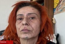 Yıldız Tilbe birinci sefer hastalığını açıkladı! Hekiminin yasağı şaşırttı
